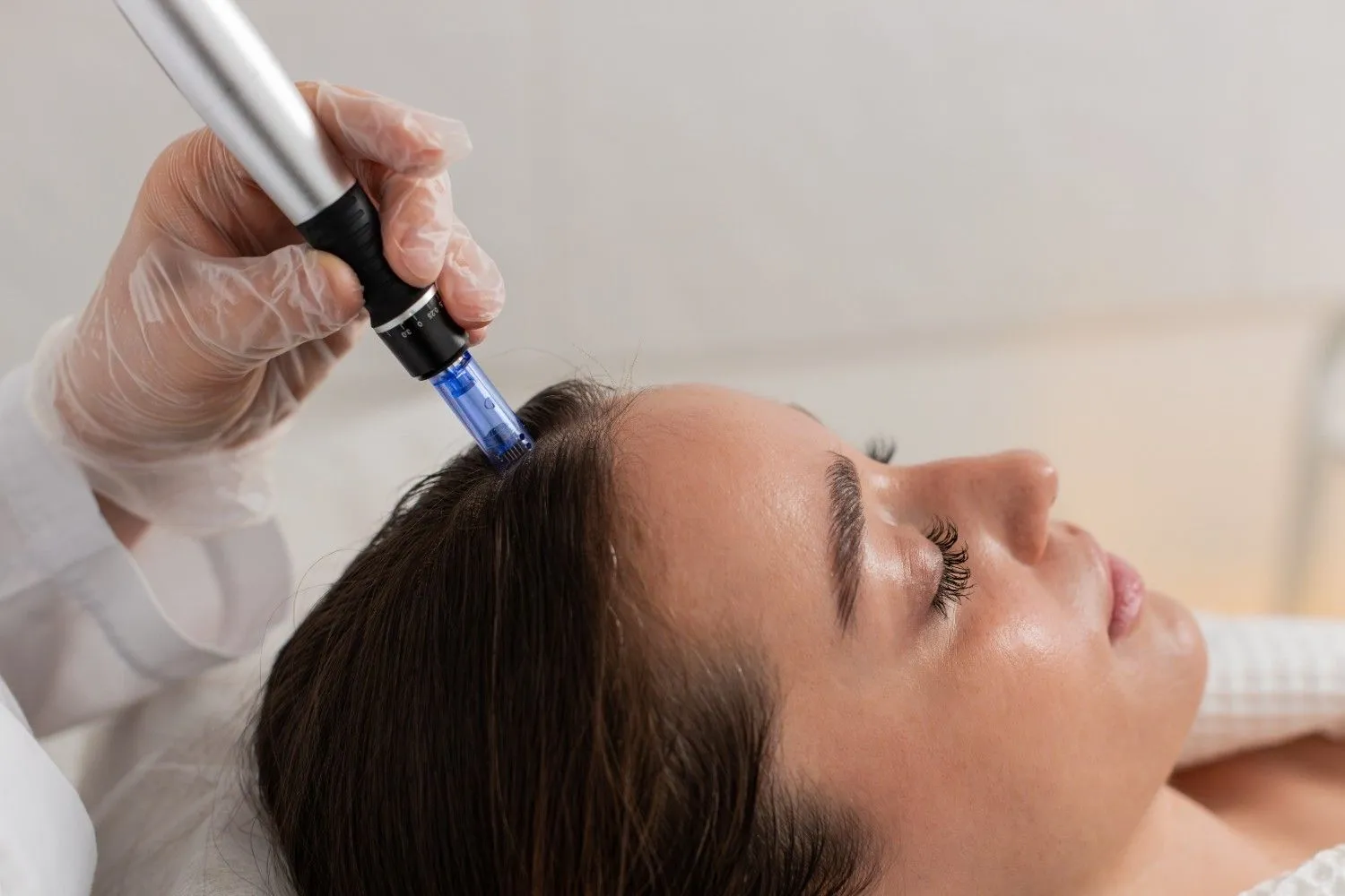 Microneedling in Mooresville, NC